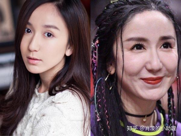 面部填充的美商queen——王子文