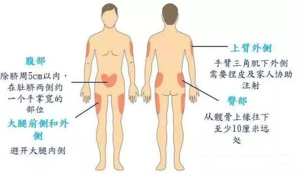 ①要想减少疼痛部位选择要合适,选择皮下脂肪丰富并没有较多神经