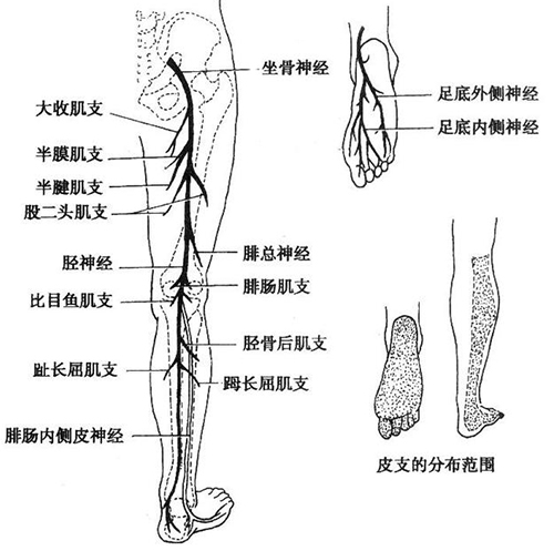 怎样才能让坐骨神经停止疼痛