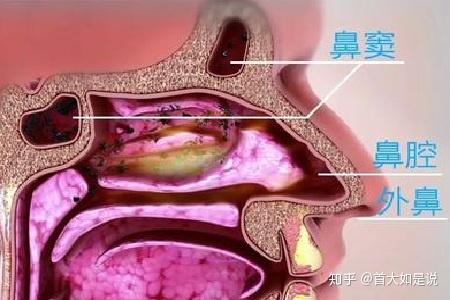 首大陈潜:鼻腔鼻窦肿瘤勿存侥幸心理 要及时就诊