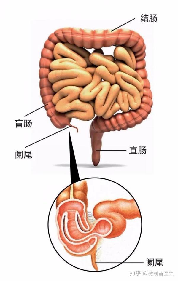 阑尾是盲肠内后壁附着的一个细长盲管,长约 5-8 cm,直径约 0.5-0.