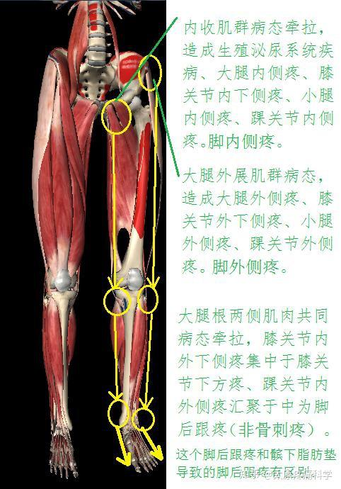 大腿内外侧肌群病态的致病路线图