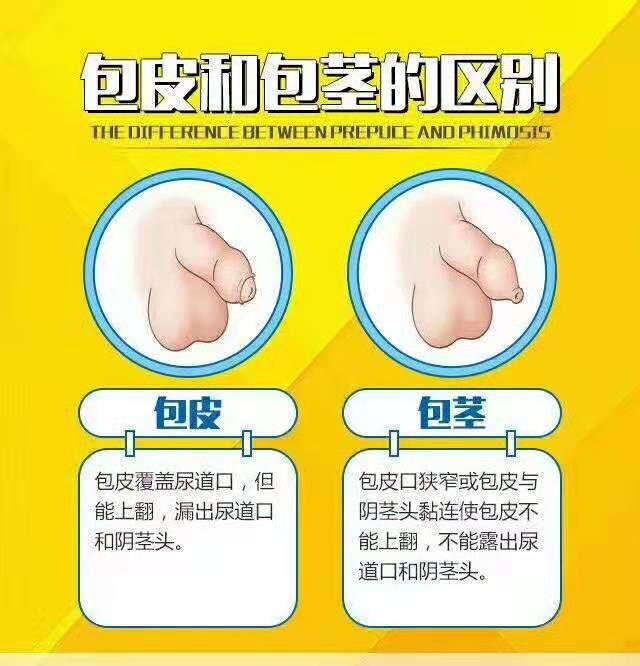 本人17中学才知道自己是包茎也有可能是包皮过长现在发育很差瞒了父母