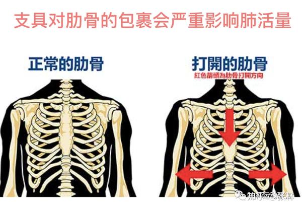 六,支具对肋骨的包裹会严重影响到佩戴者的肺活量