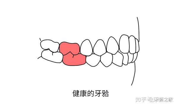 科普安氏分类ⅠⅡⅢ你的牙齿是哪类