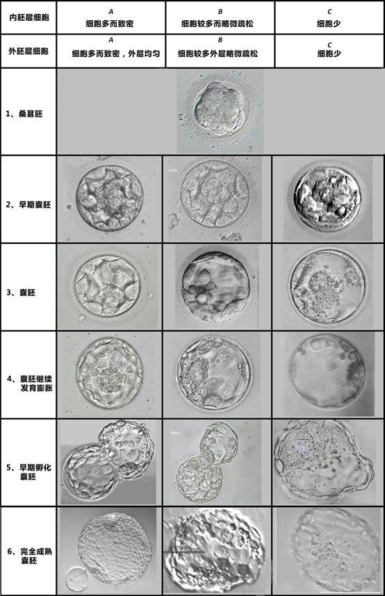 囊胚的评分在世界范围都差不多,一般以囊胚腔等级 内细胞团等级 外