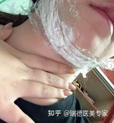 韩国红溶脂注射步骤