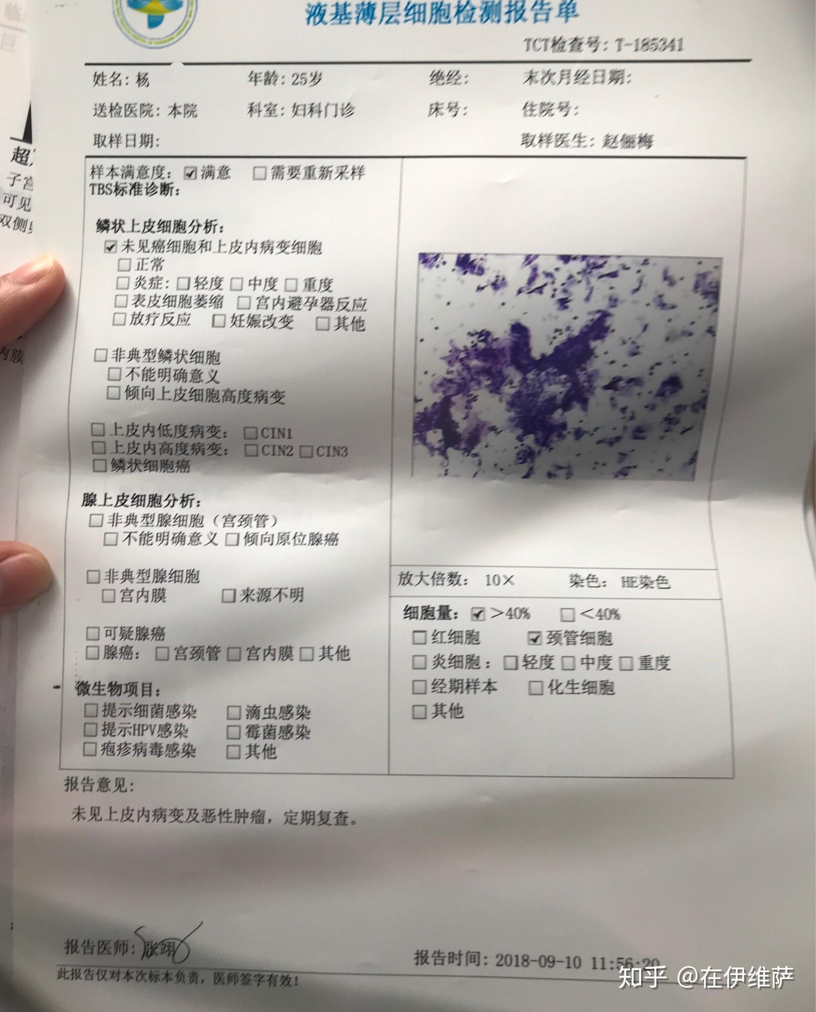 hpvhpv16cin2累及腺体记录一下希望一切顺利安好