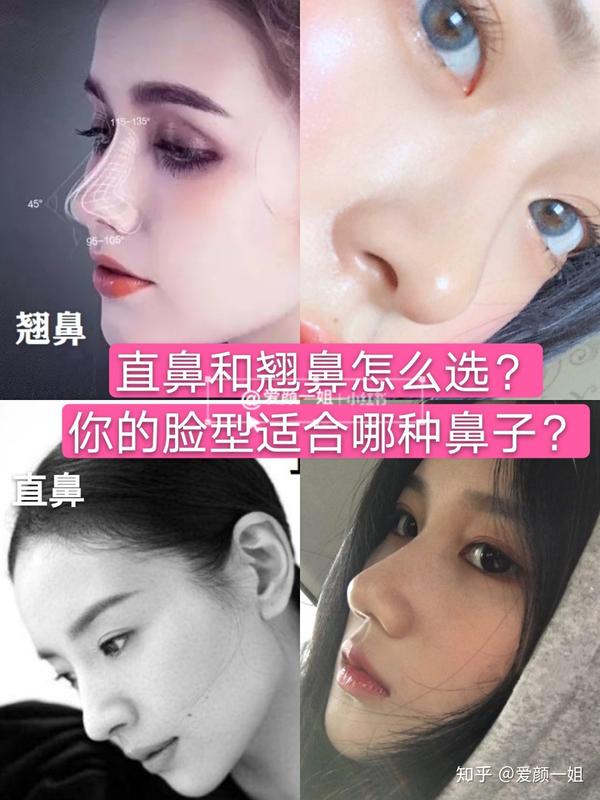 你的脸型想做直鼻和翘鼻怎么选择71