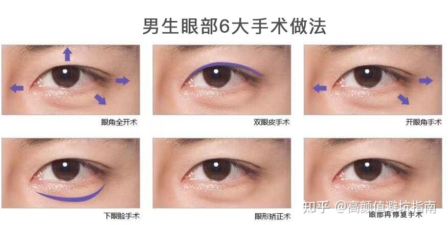 男生眼部整形的正确审美观