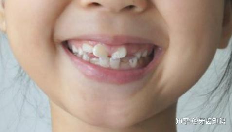 广州关爱儿童牙齿健康发育