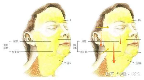 肌肉的松弛和脆弱,是造成面部软组织下移的重要原因之一 皮肤