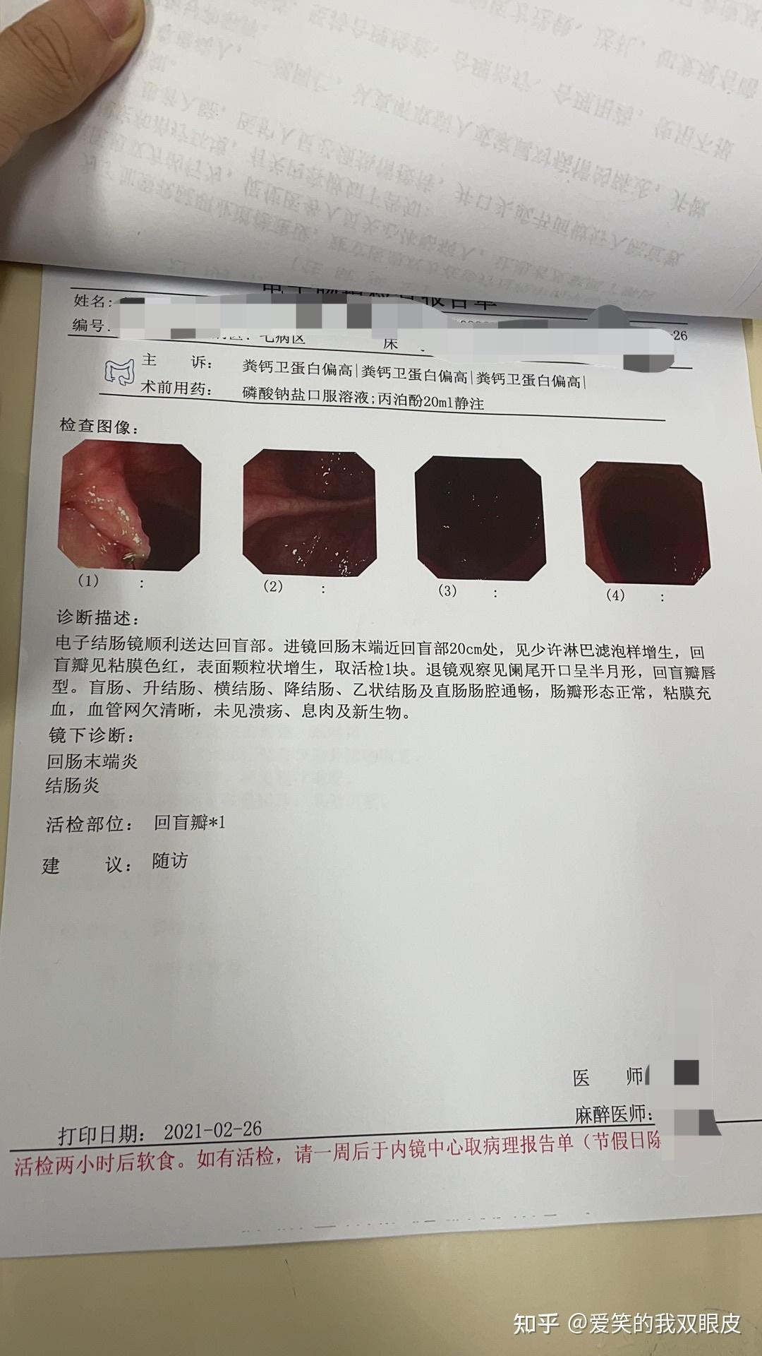 肠镜与小肠增强ct日记