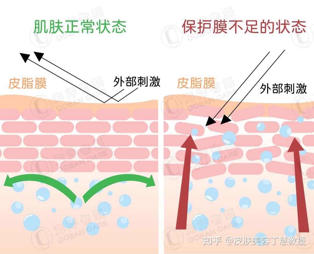 脸部皮肤屏障受损怎么修复