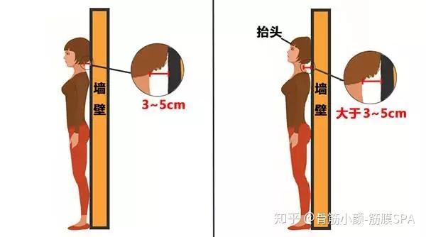 不正确的站坐姿,长时间的伏案学习和工作,颈椎缺少活动,脊柱损伤