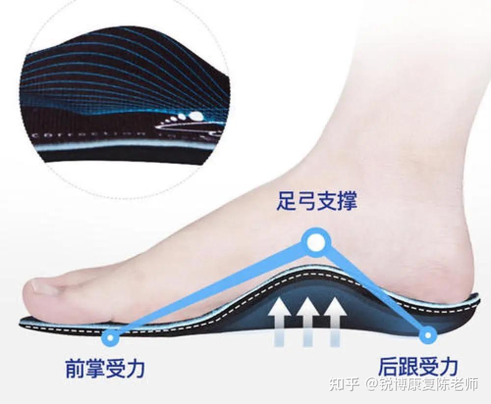 锐博康复扁平足or足弓塌陷脚平的你还有没有救
