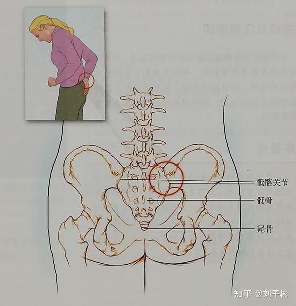 易误诊为腰椎病的骶髂关节错位从医随笔之十四