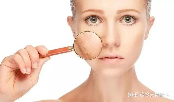 7,皮肤变差