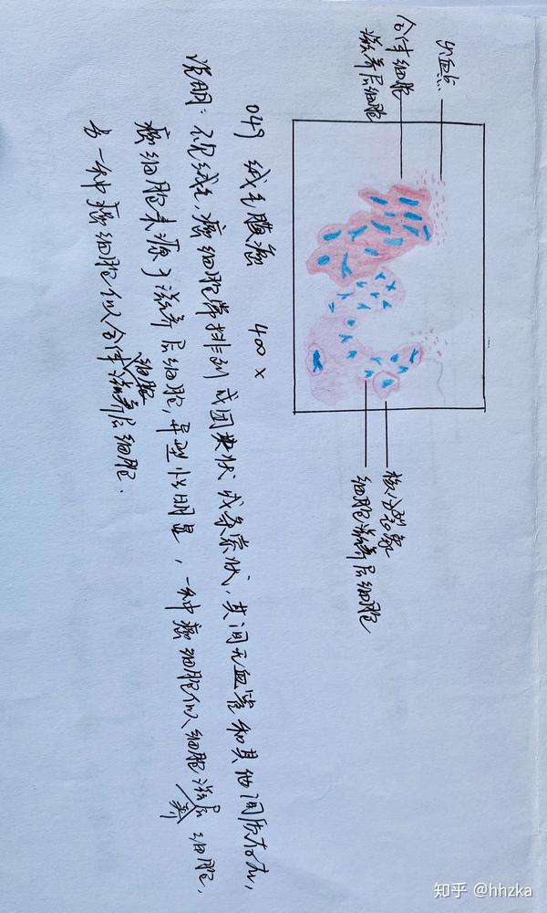 病理学切片红蓝铅手绘图