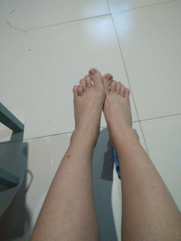 你们会介意女孩子脚趾畸形么?