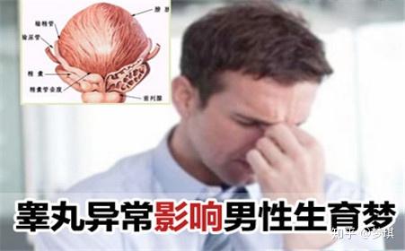 睾丸炎危害大吗一个不小心就会不孕不育