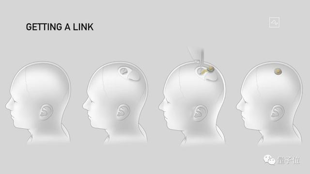 马斯克活猪脑机接口试验成功多芯片植入硬币大小实时读取脑电波