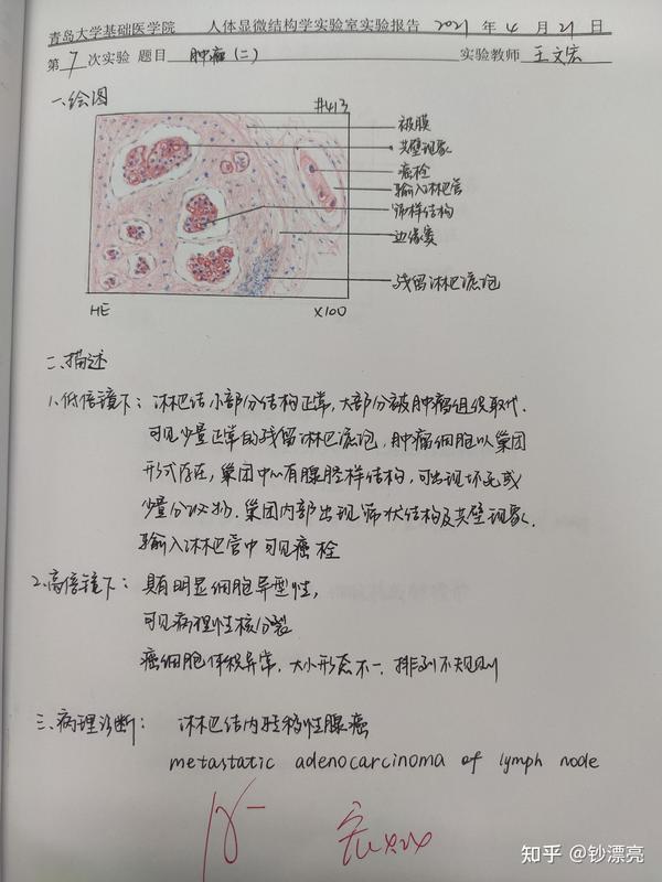 7.肿瘤(二)——淋巴结内转移性腺癌