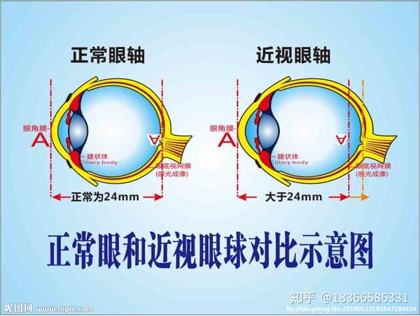 1. 视力训练与视觉形成过程