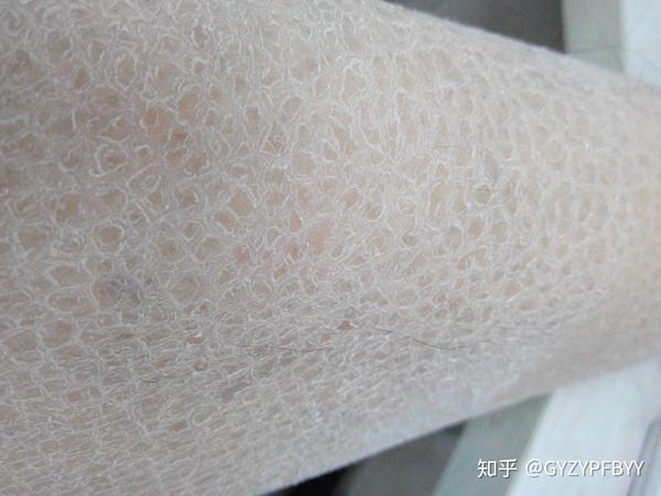 贵阳看什么专业医院能治鱼鳞病