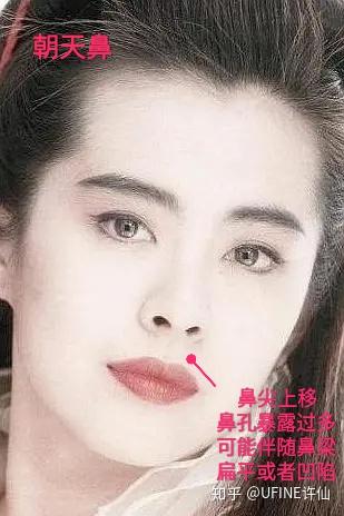 世界公认最丑鼻型!你躺枪了吗?