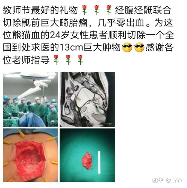 骶尾部畸胎瘤…病例少希望能帮到同病的人