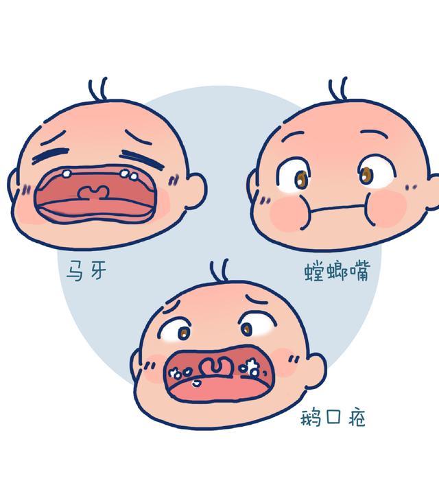 为正常现象,可自行消失,不要挑破,以防造成感染