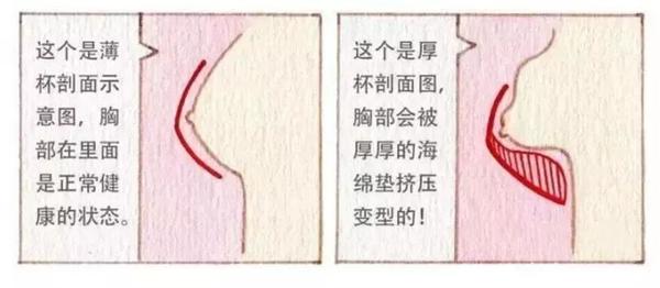 长期下来容易形成副乳, 让胸部轮廓松散,形成外扩和下垂