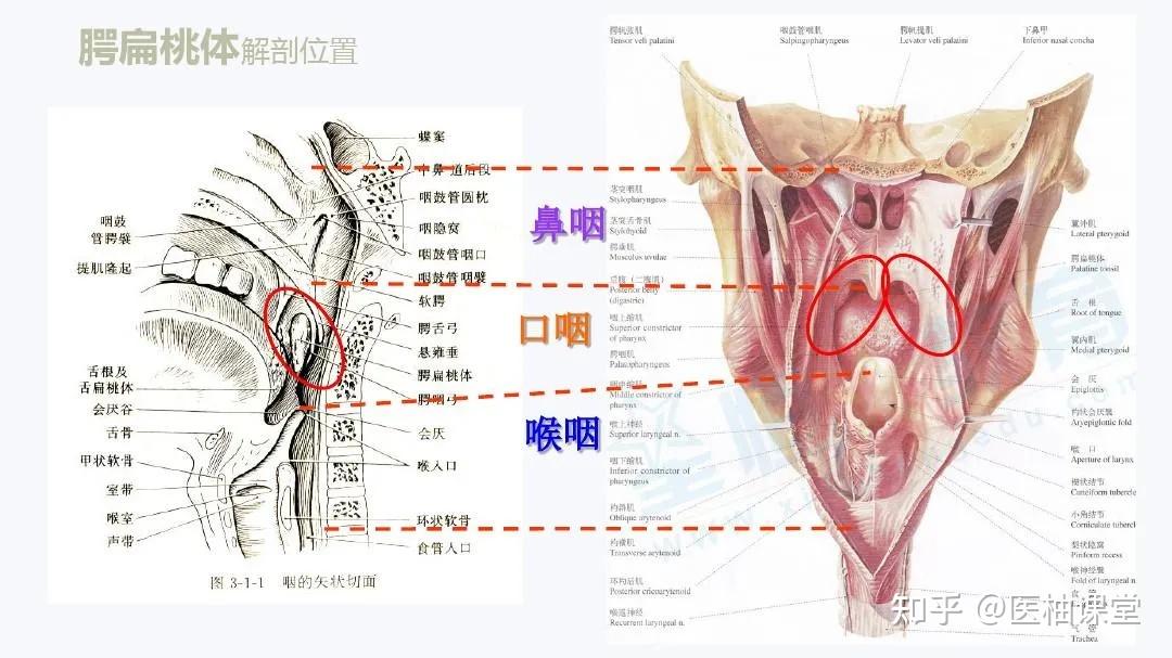 腭扁桃体解剖位置18 人赞同了该文章微信关注"医柚课堂,获取您的专属