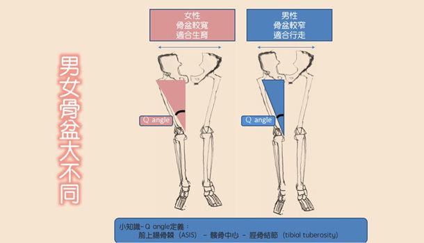 髂胫束综合征是导致跑步者膝关节外侧疼痛最常见的原因.