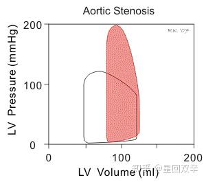 Left Ventricular Pressure Volume Pv Loops