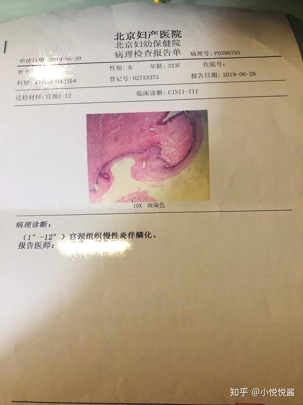 锥切术后病理报告