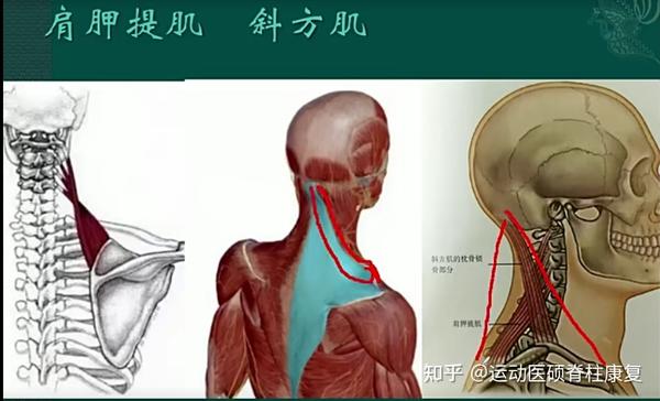 头前引肌肉力量失衡分析4