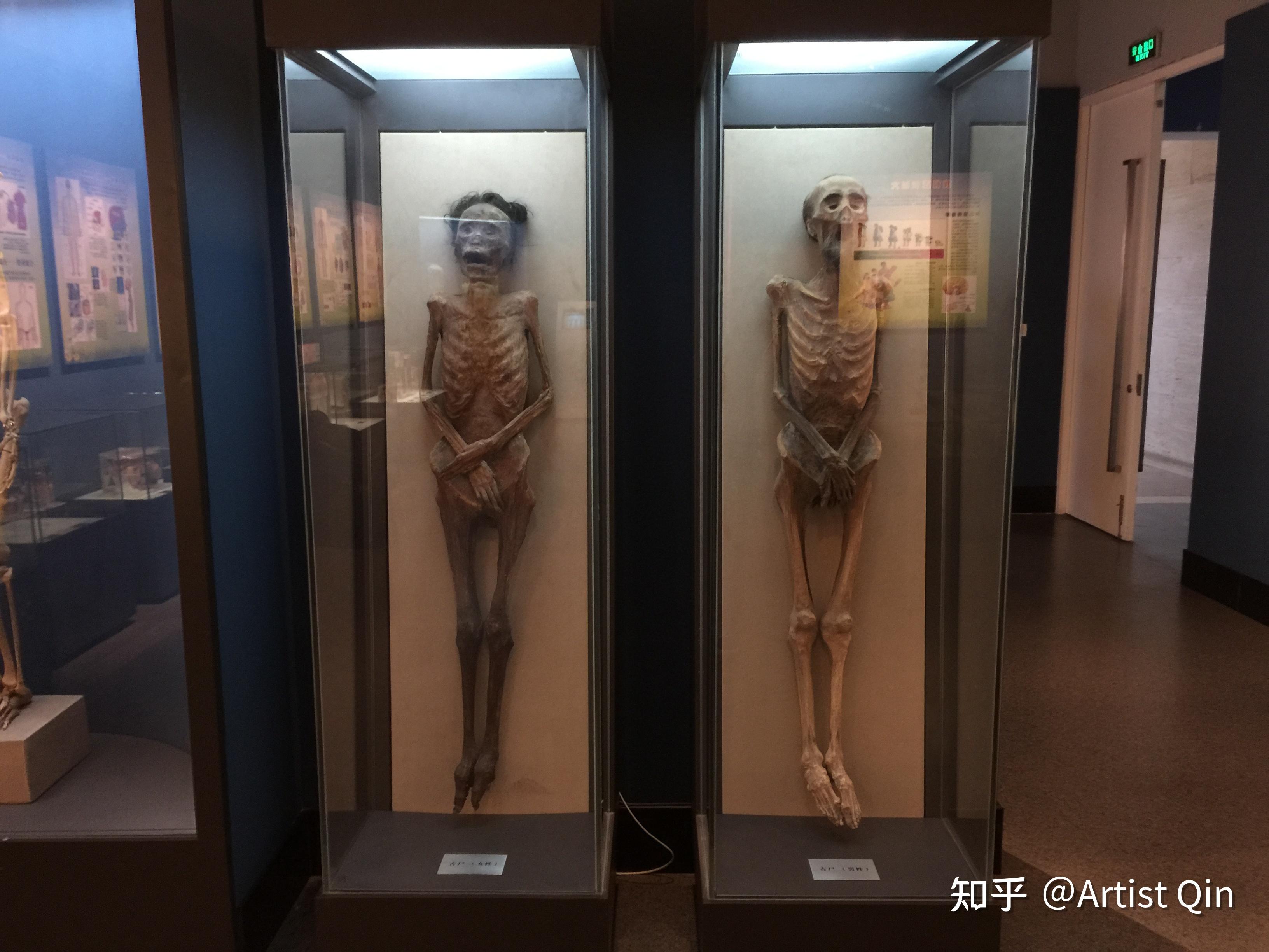 杭州自然博物馆里的人体标本是真的吗