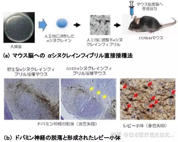 这次制备的小鼠可以再现路易体缓慢发展的病理,以及黑质多巴胺神经的