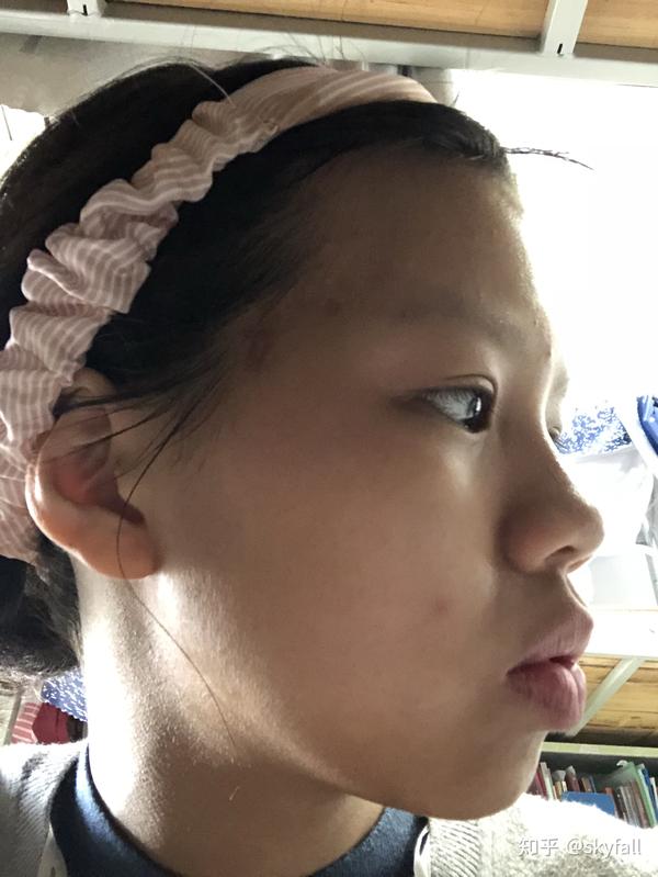 正脸好看但侧脸丑到爆是种怎样的体验?
