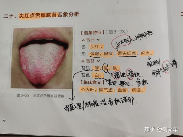 尖红点舌厚腻苔舌象分析