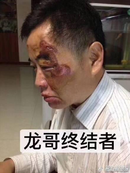 如何看待昆山震川路龙哥砍人被反杀事件?被砍男子行为