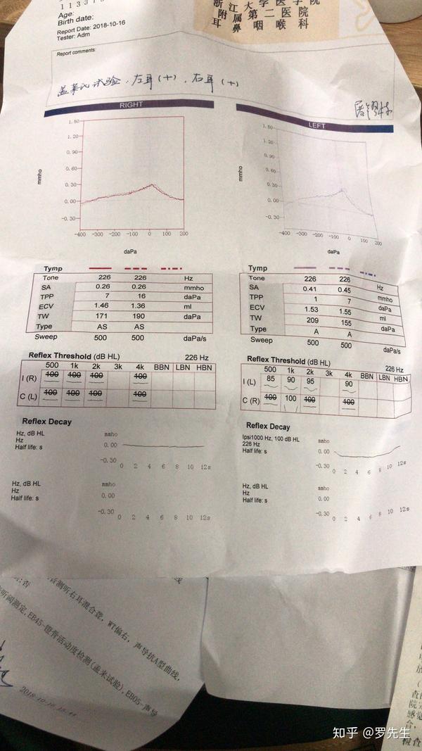 耳鸣,做了声导抗测听和纯音听阀测定报告不会看,谁愿意来解释一下报告