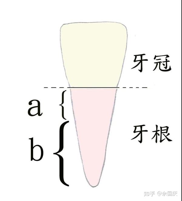 当牙齿只剩牙根时,拔还是不拔?