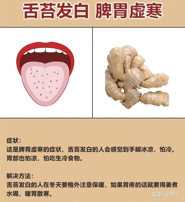 从舌苔颜色看身体健康状况脾胃虚寒肠胃不适统统不见