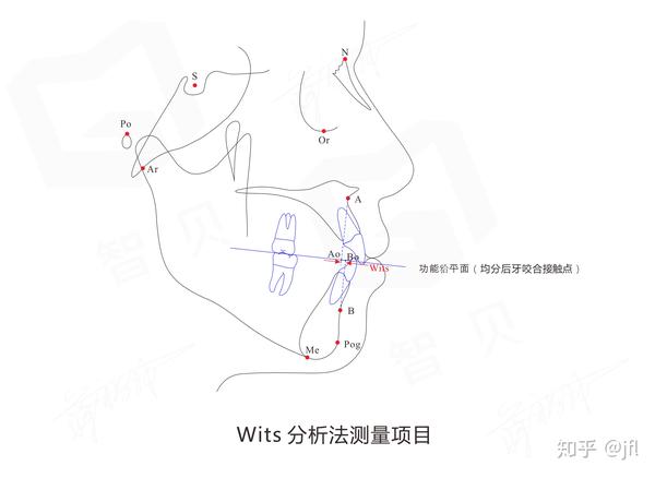 正畸侧位片,如何进行头影测量?