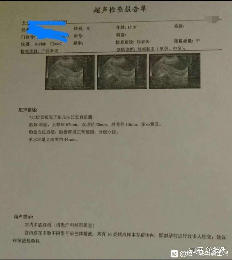 女性妇科检查单上的gpal和精元抗体是什么意思