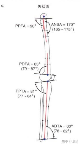 下肢冠状面解剖轴及关节走行方向角