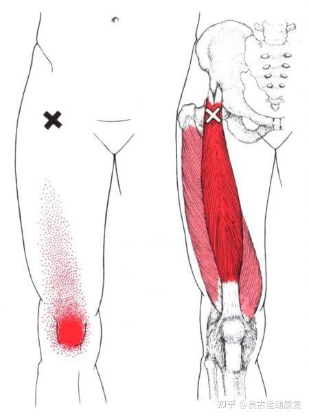 24,胫前肌(tibialis anterior) 小腿前侧,脚背部,大脚指